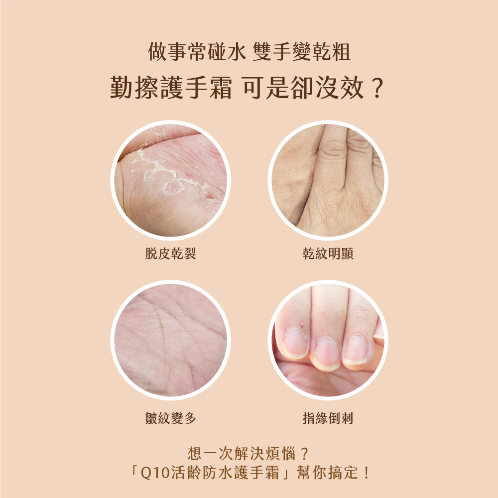 KOSE Q10活齡 官方直營  賦活防水護手霜EX80g | 購綺麗, , large