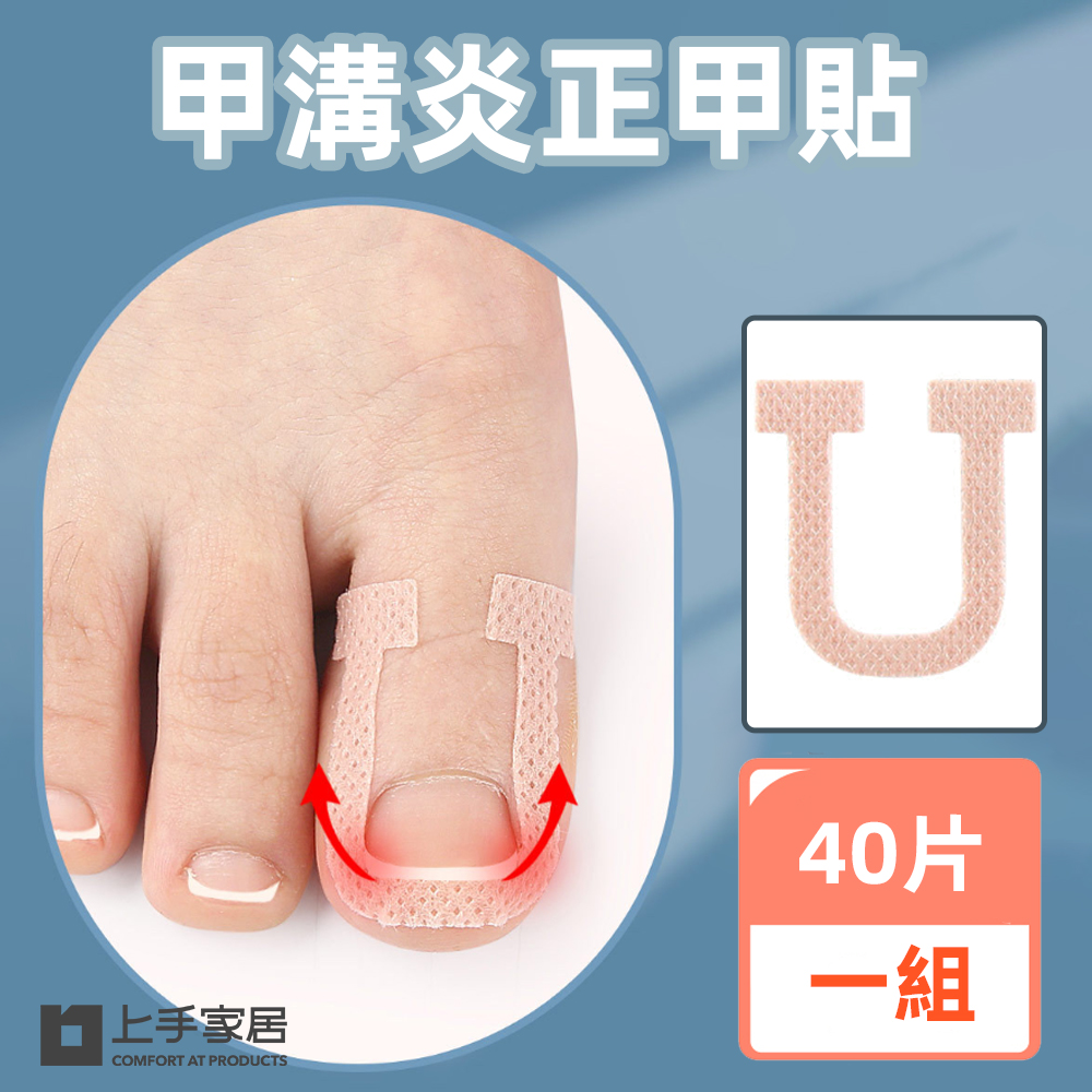 ingrown-toenail-correction-patch-40pcs, , large