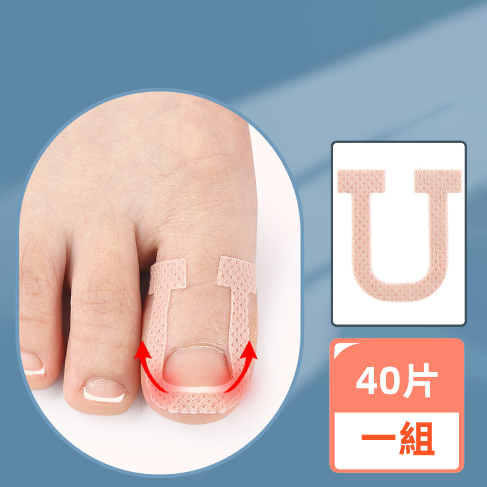 ingrown-toenail-correction-patch-40pcs, , large