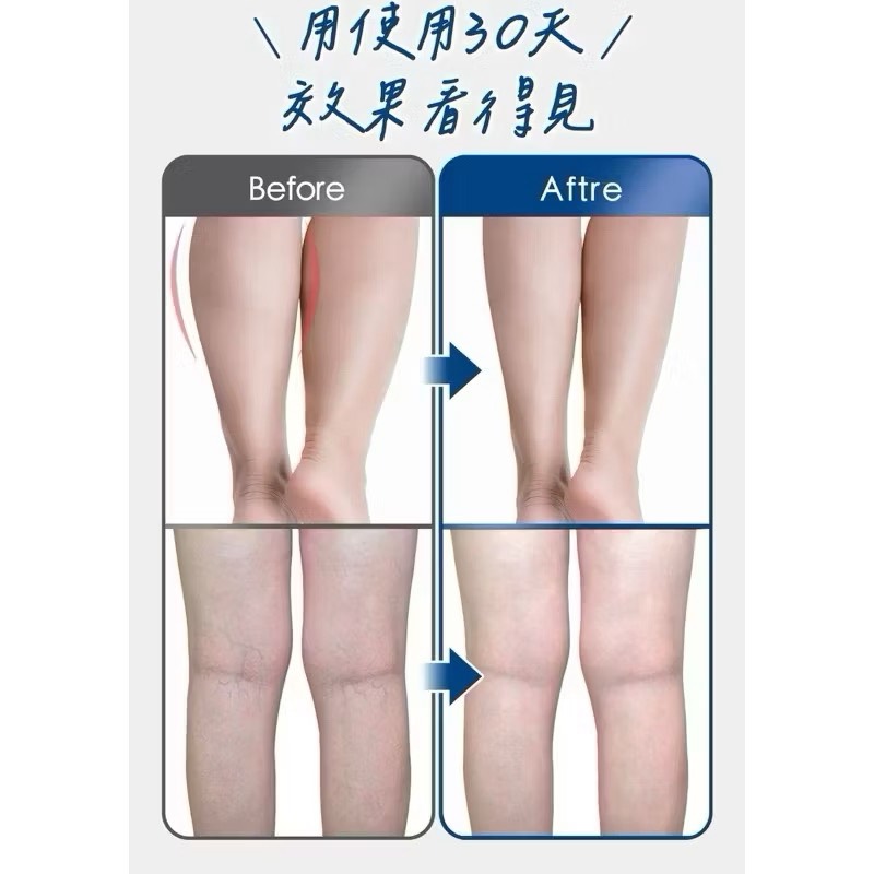 【Leo手機周邊專賣店】TreasHunter Slimmer追夯特 纖潤美腿儀 / 單入組, , large