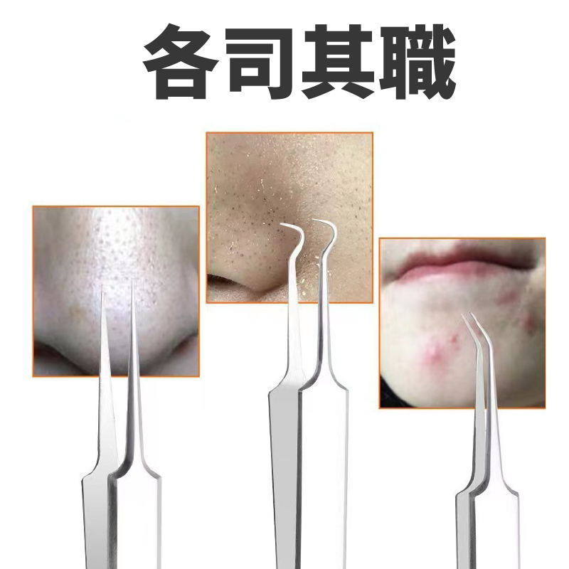 Blackhead Remover Tools, Professional Stainless Steel Extractor Kit, Acne Pimple Popper, Whitehead Tweezers, Acne Tweezer, SUNDEN SD1640-SD1642, , large