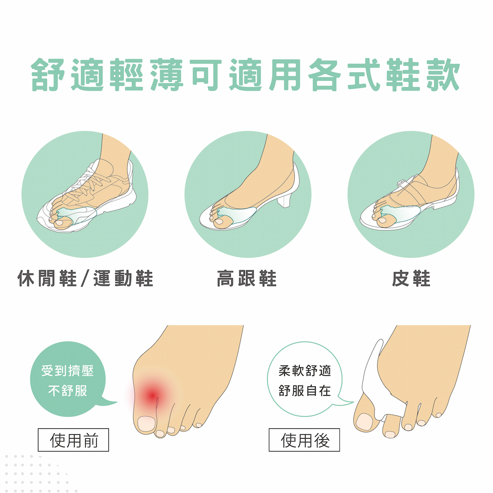 【GelSmart吉斯邁】拇趾偏斜防磨分趾墊-雙環型-2入(左右腳通用、0.5cm分趾墊、TG-GTS0062-L), , large