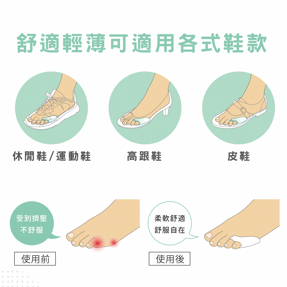【GelSmart吉斯邁】小趾偏斜防磨分趾墊-雙環型-2入(左右腳通用、0.5cm分趾墊、TG-GTS0062-S), , large