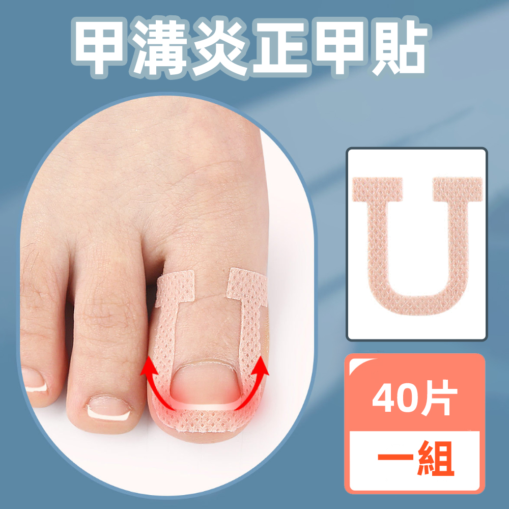ingrown-toenail-correction-patch-40pcs, , large