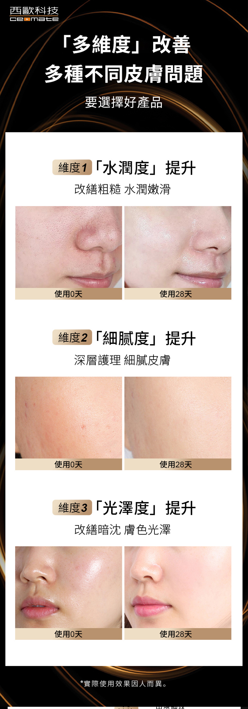 西歐科技 藍鑽石童顏美容儀 CME-BE2000(贈送SK-II專櫃保養品), , large